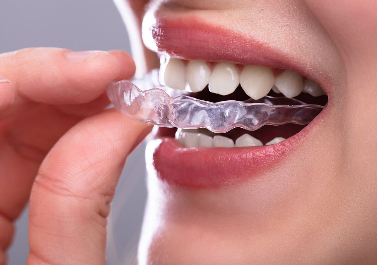 SureSmile Orthodontic Treatment in Lowell MA Area